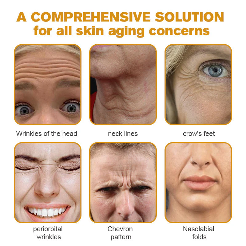 👨‍⚕️ Botox Bee Venom Wrinkle Removal Cream- LAST DAY 70% OFF✅