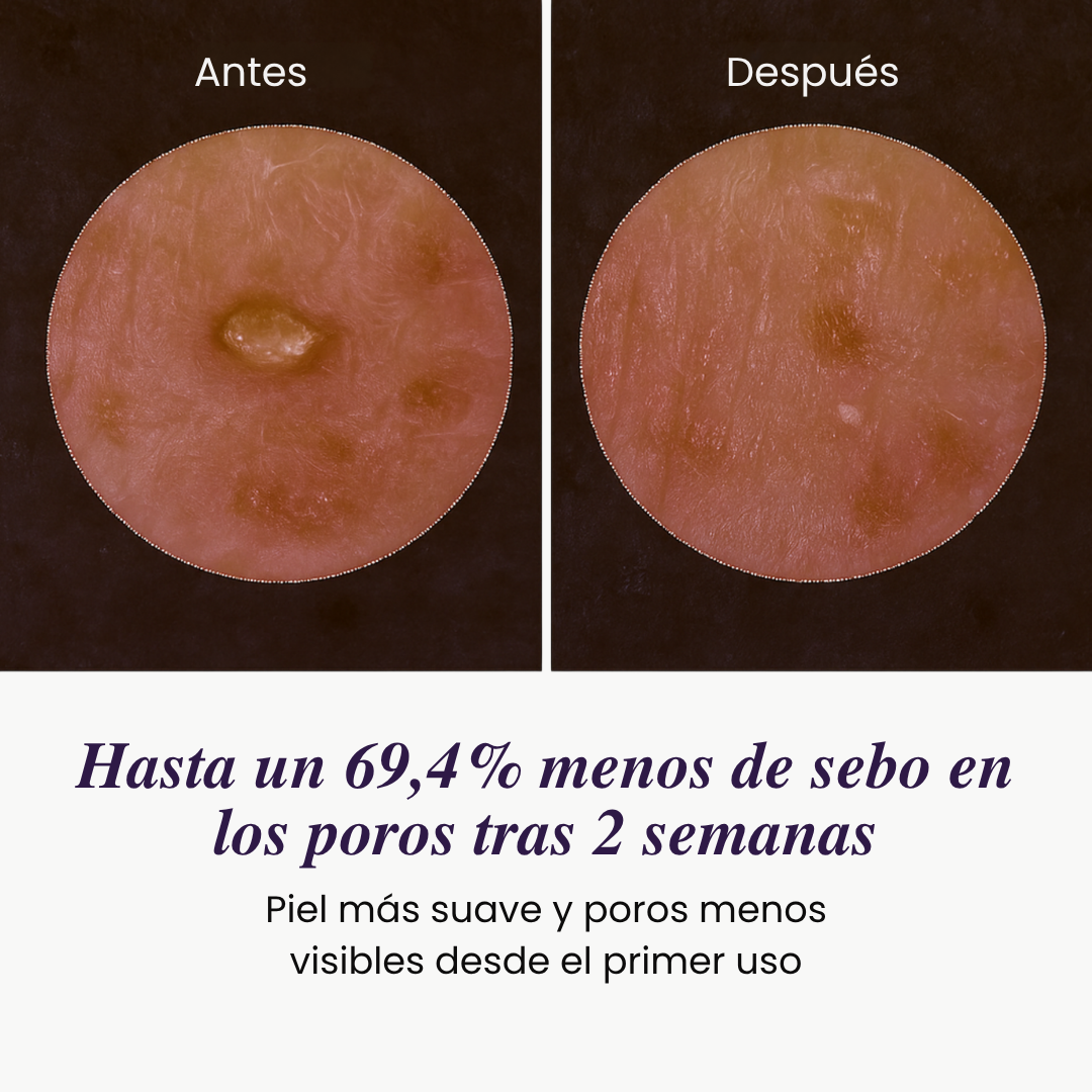 Ampolla Exfoliante con Arroz — Luminosidad Radiante