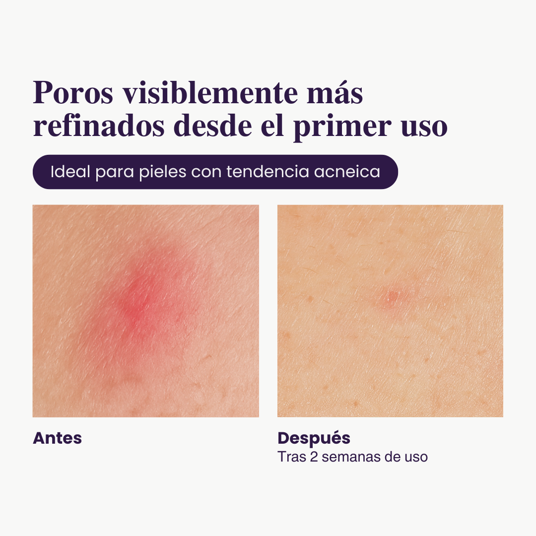 Ampolla Exfoliante con Arroz — Luminosidad Radiante