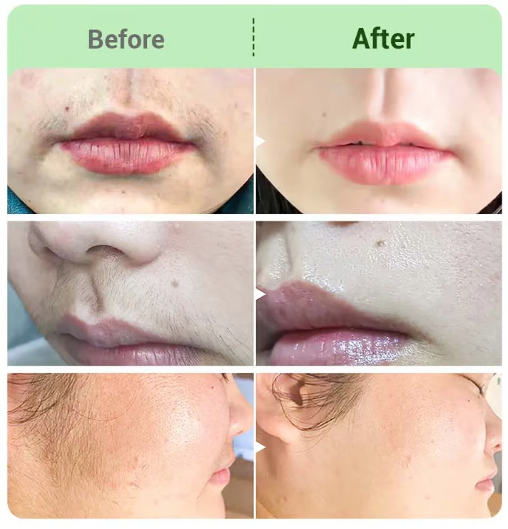 🤩Hair Removal Cream Kit for Women🤩