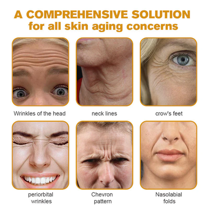 👨‍⚕️ Botox Bee Venom Wrinkle Removal Cream- LAST DAY 70% OFF✅