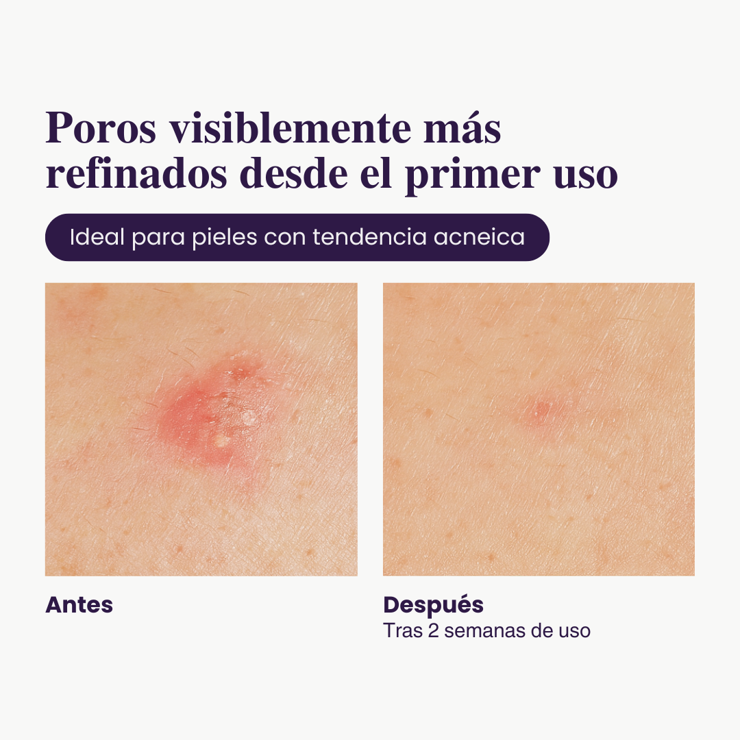 Ampolla Exfoliante con Arroz — Luminosidad Radiante