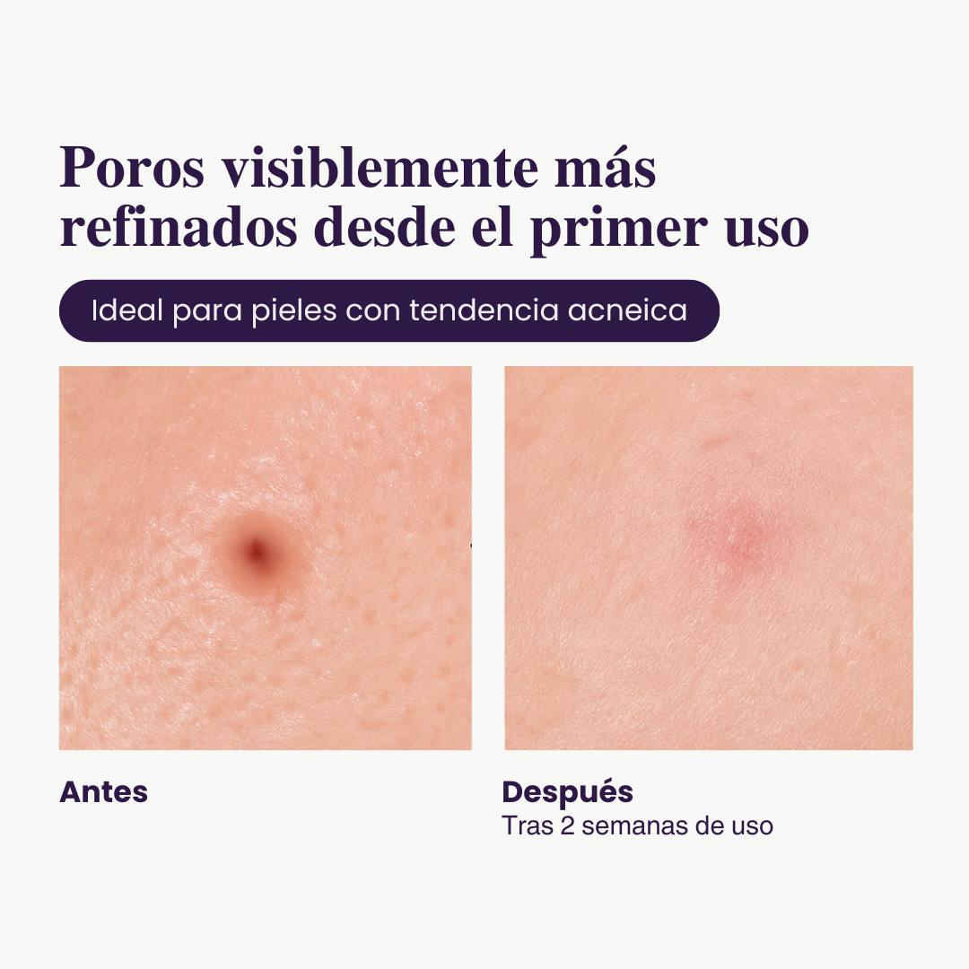 Ampolla Exfoliante con Arroz — Luminosidad Radiante