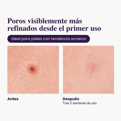 Ampolla Exfoliante con Arroz — Luminosidad Radiante