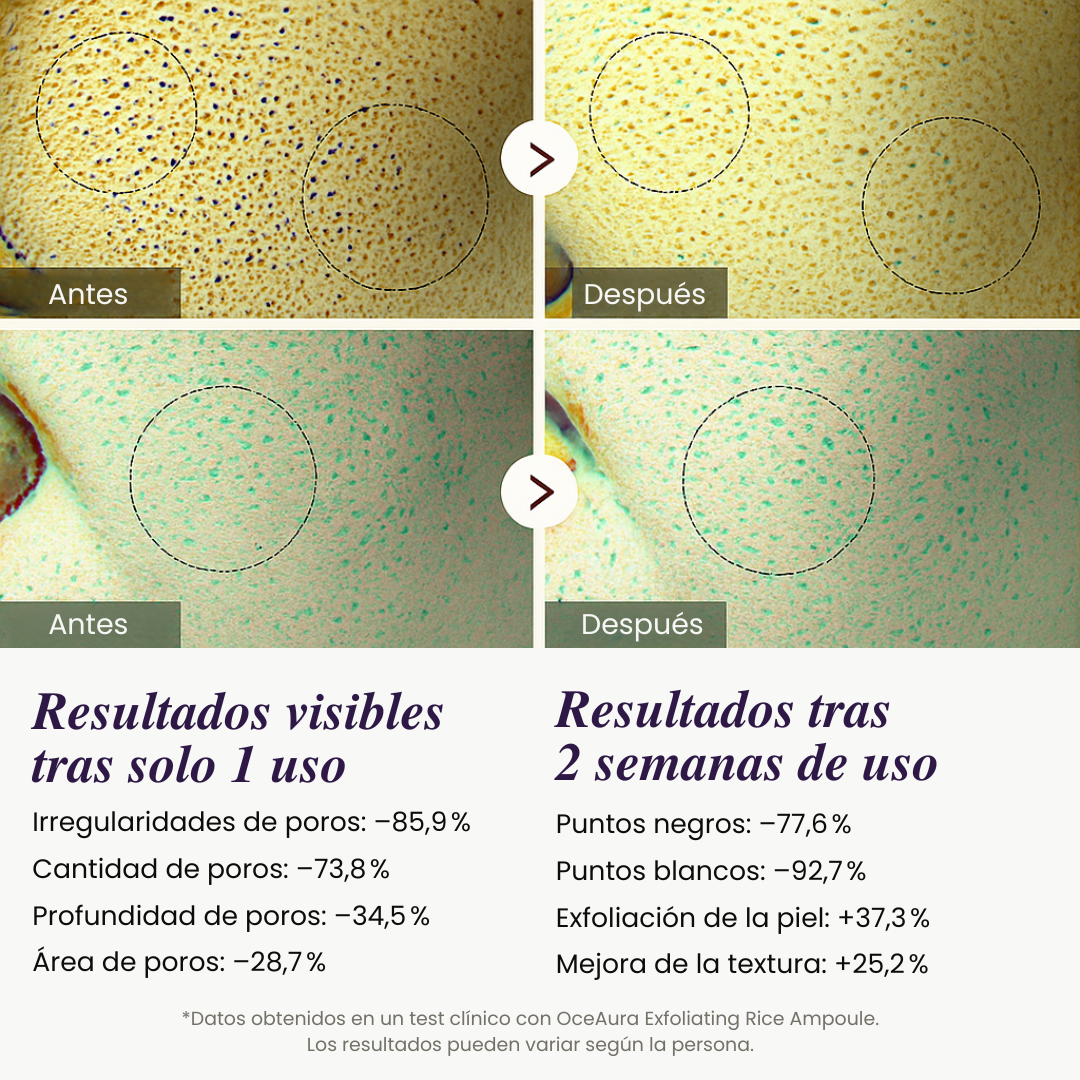 Ampolla Exfoliante con Arroz — Luminosidad Radiante
