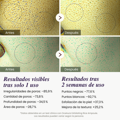 Ampolla Exfoliante con Arroz — Luminosidad Radiante